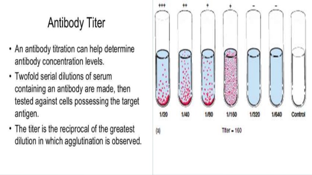 Importance Of Serial Dilution In Serology